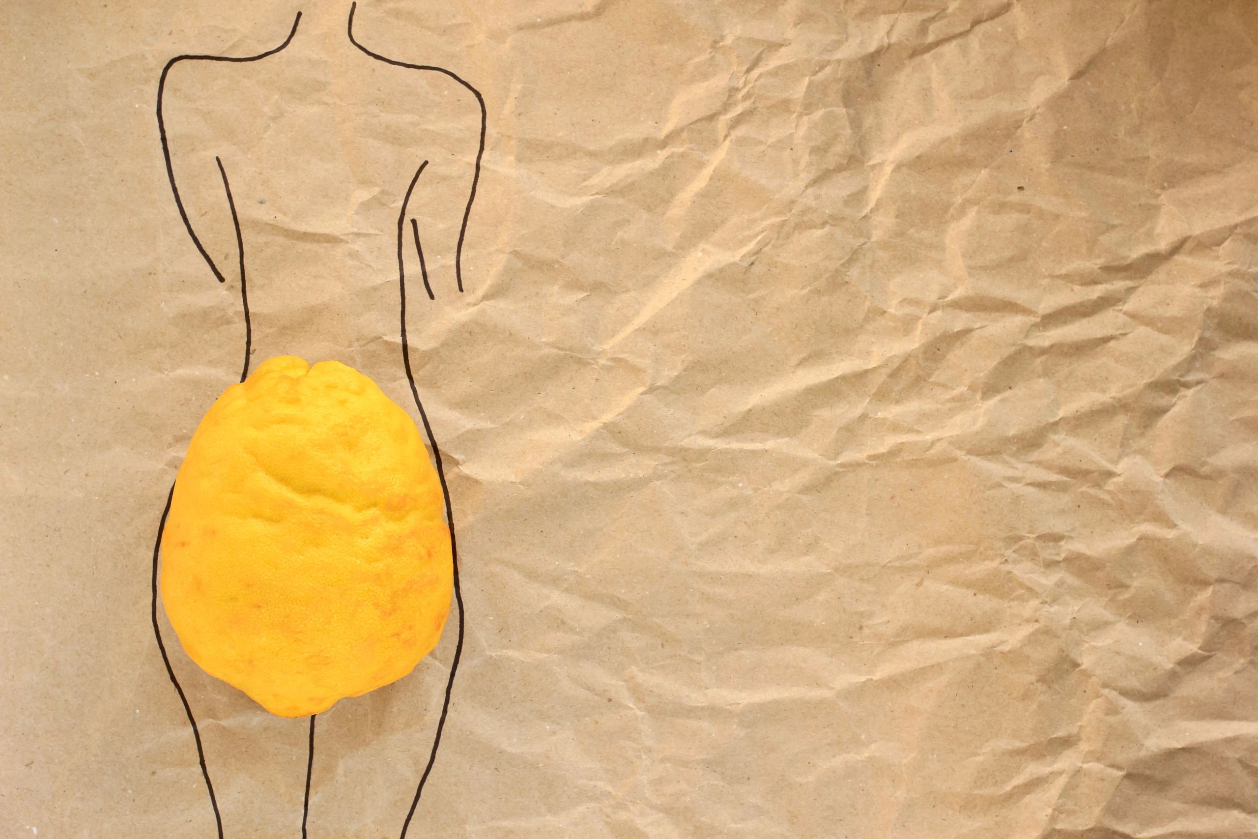 pigmentation and vascular treatments